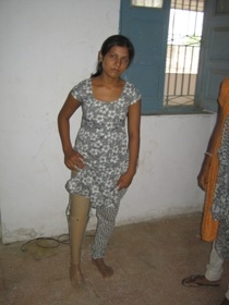 Standing tall withe her Jaipur foot