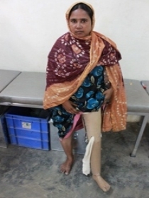 Old lady with Jaipur Foot