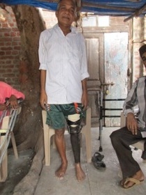 Standing tall with his Jaipur foot