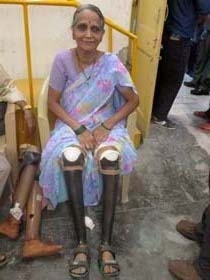 Aged women wearing Jaipur Feet