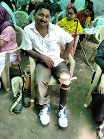  Man with Jaipur Foot