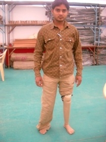 Standing tall with his  Jaipur foot