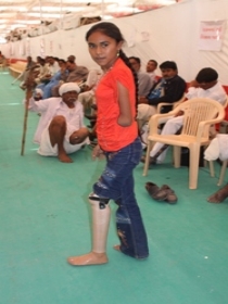 Standing tall with her Jaipur foot