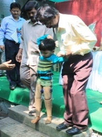 Child with Jaipur Foot