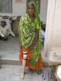 Standing tall with her  Jaipur foot
