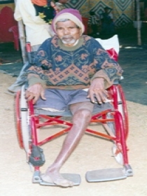 Disabled man on a wheelchair