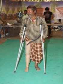 Old Man with Jaipur Foot