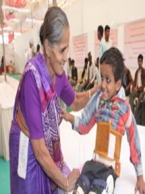 Polio Patient supported by calipers