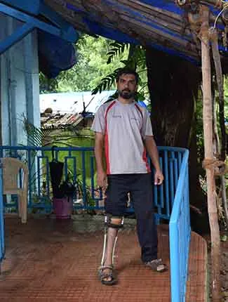 Prosthetic Limbs