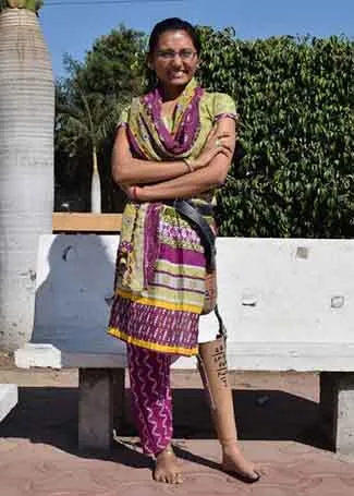 Donated Artificial Legs