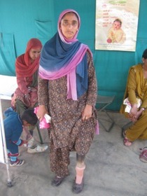 StandingtallwithherJaipurfoot