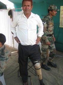 StandingtallwithhisJaipurfoot