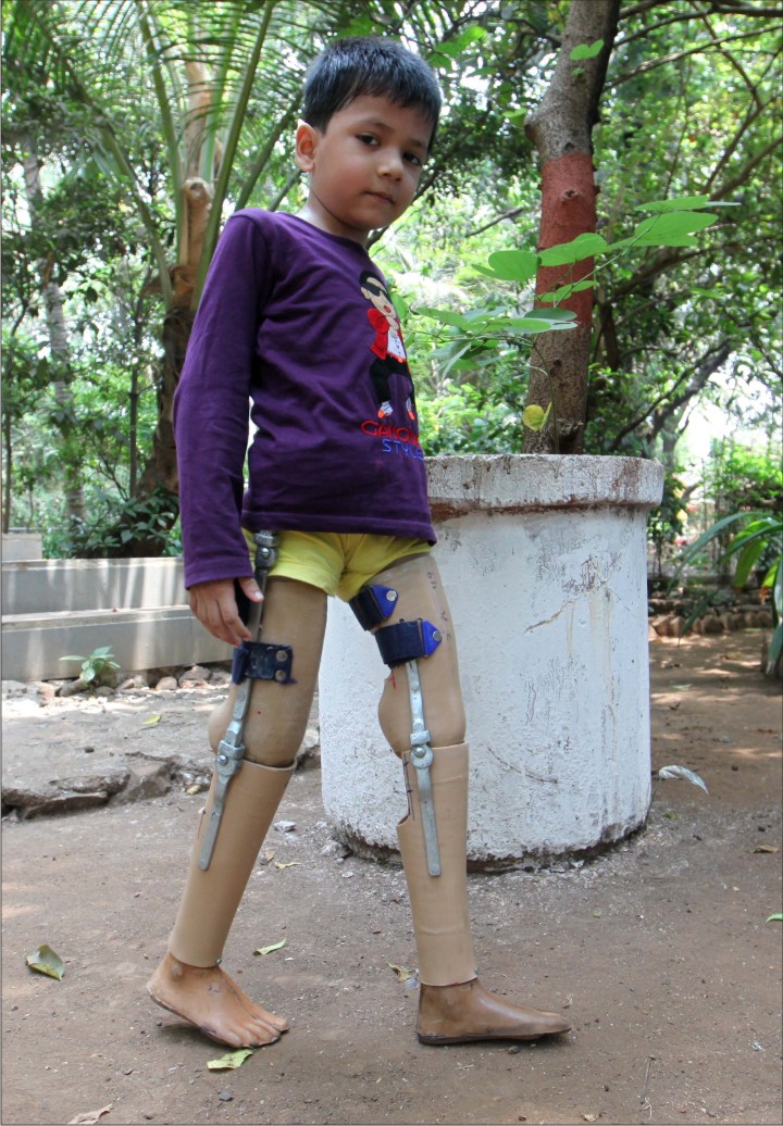 AbdulwearingJaipurFoot