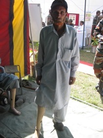 StandingtallwithhisJaipurfoot