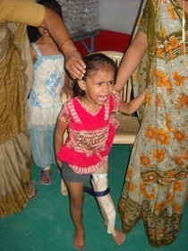 StandingtallwithherJaipurfoot