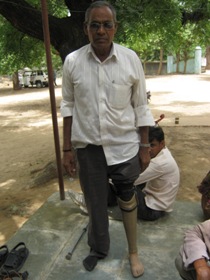 StandingtallwithhisJaipurfoot
