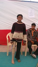 StandingtallwithhisJaipurfoot