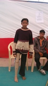 StandingtallwithhisJaipurfoot