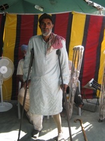 StandingtallwithhisJaipurfoot