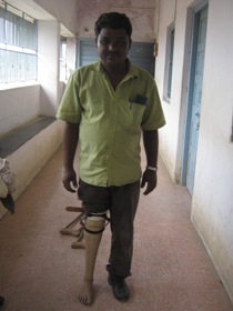 StandingtallwithhisJaipurfoot