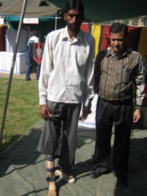 StandingtallwithhisJaipurfoot