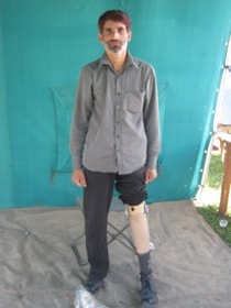 StandingtallwithhisJaipurfoot