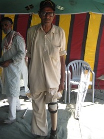 StandingtallwithhisJaipurfoot