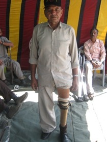 StandingtallwithhisJaipurfoot