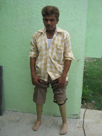 StandingtallwithhisJaipurfoot