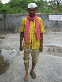 StandingtallwithhisJaipurfoot