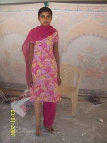StandingtallwithherJaipurfoot
